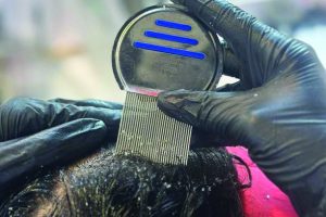 لاین ضد شوره