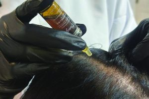 لاین ضد ریزش