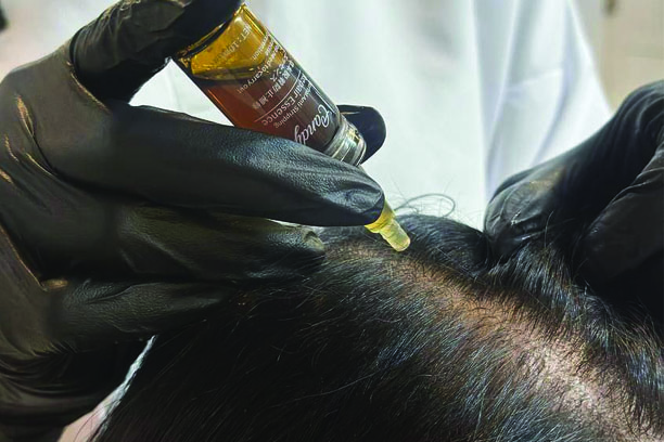 لاین ضد ریزش