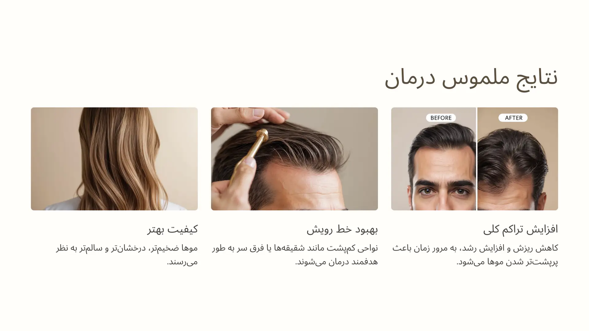  نتایج ملموس: افزایش تراکم و بهبود خط رویش مو