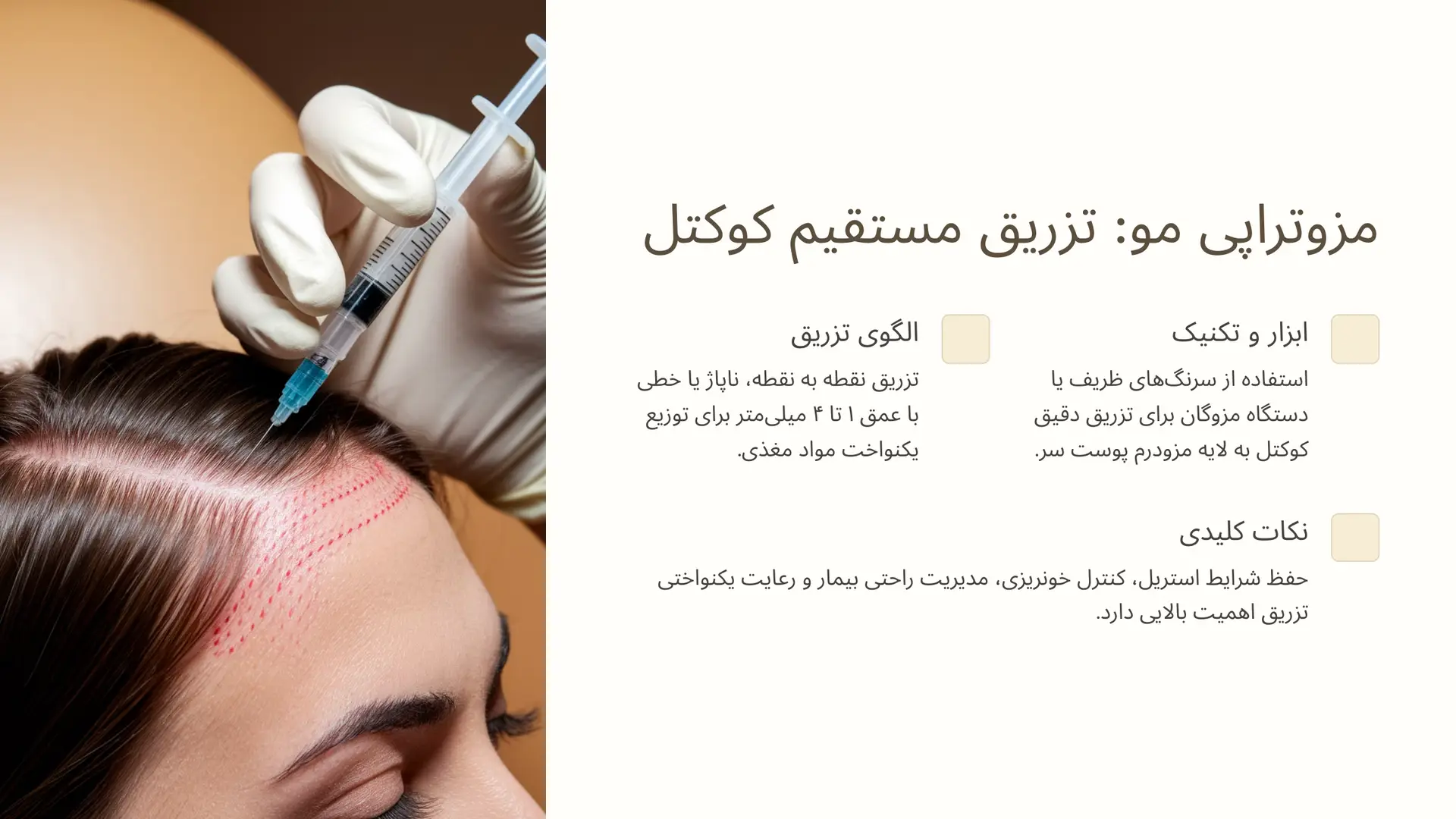 روش اول: مزوتراپی مو (تکنیک تزریق مستقیم)